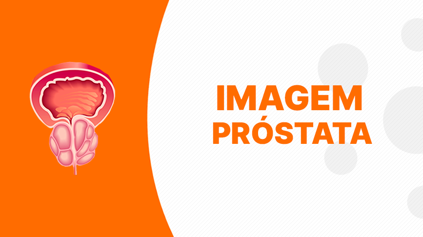 Banner - Dominando a ressonância magnética de próstata: um guia abrangente