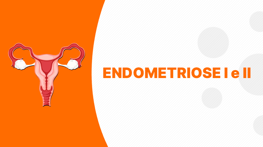 Banner - Imagem em Endometriose I: conceitos e prática
